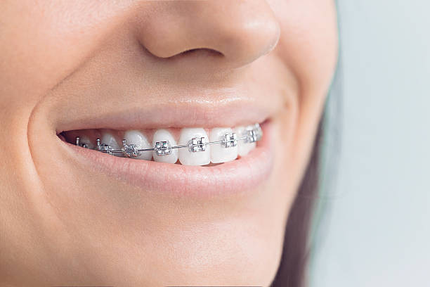 Best Invisalign and Clear Aligners  in Asotin, WA